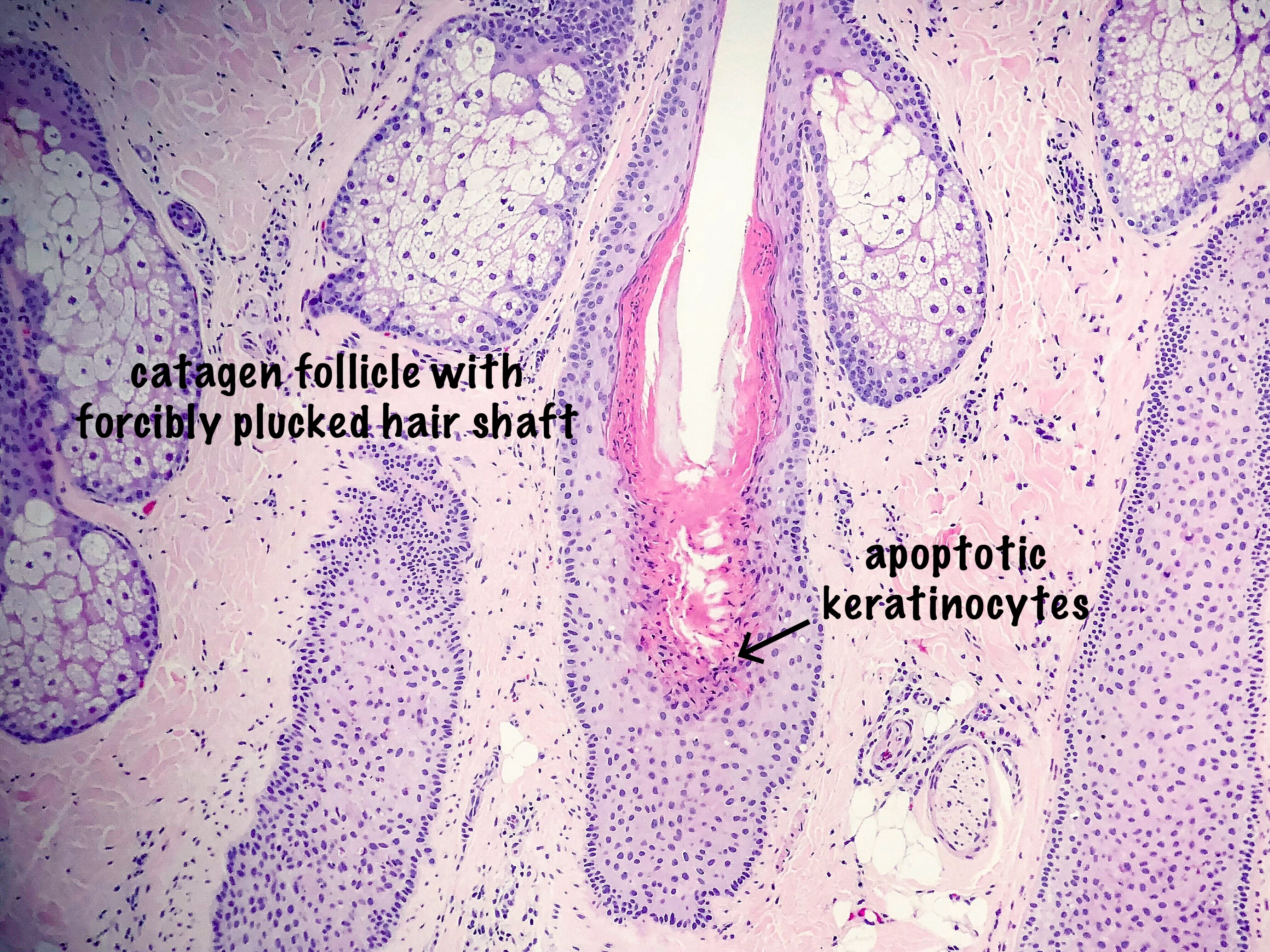 hair follicle histology